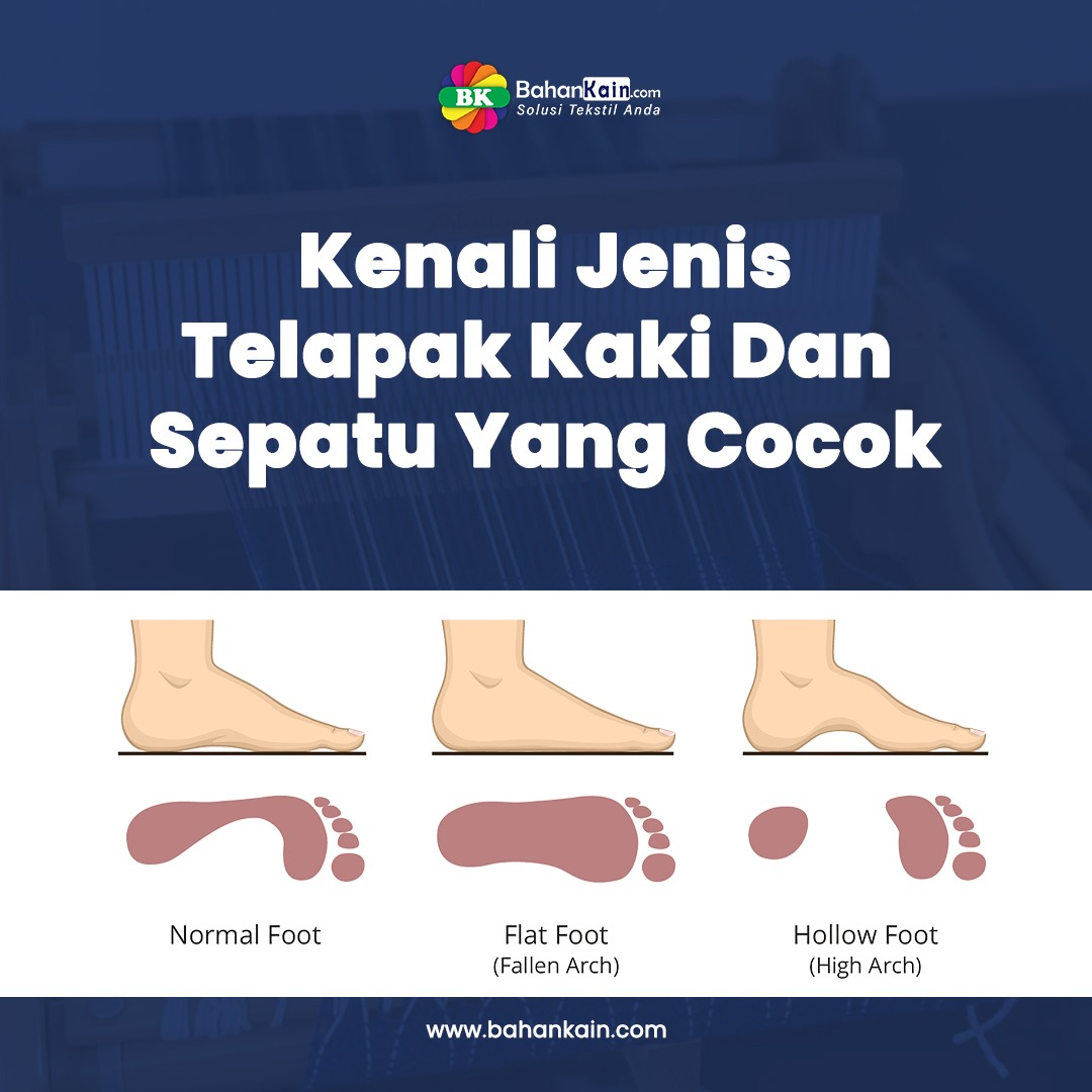 Kenali Jenis Telapak Kaki Dan Sepatu Yang Cocok